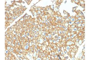 Immunohistochemistry (IHC) image for anti-Epithelial Cell Adhesion Molecule (EPCAM) antibody (ABIN6939998)