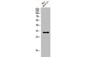 Western Blot analysis of rat-musle cells using p57 Polyclonal Antibody (CDKN1C 抗体  (N-Term))