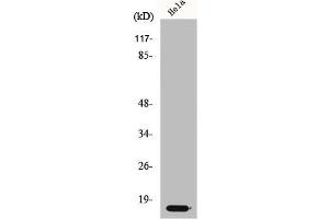 Western Blot analysis of HeLa cells using p14 Polyclonal Antibody (CDKN2A 抗体  (Internal Region))