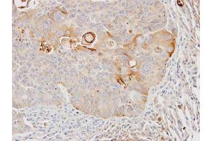 IHC-P Image Immunohistochemical analysis of paraffin-embedded SW480 xenograft, using GSTA4, antibody at 1:100 dilution. (GSTA4 抗体)