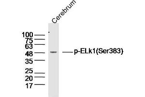 Mouse brain lysates probed with Elk1(Ser383) Polyclonal Antibody, unconjugated  at 1:300 overnight at 4°C followed by a conjugated secondary antibody at 1:10000 for 90 minutes at 37°C. (ELK1 抗体  (pSer383))