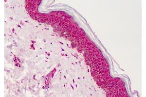 Human Skin: Formalin-Fixed, Paraffin-Embedded (FFPE) (PPARG 抗体  (Internal Region))