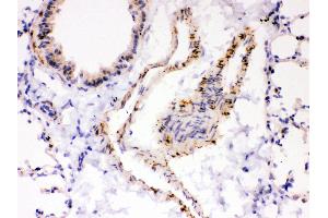 Immunohistochemistry (IHC) image for anti-ATPase, Ca++ Transporting, Cardiac Muscle, Fast Twitch 1 (ATP2A1) (AA 1-32), (N-Term) antibody (ABIN3043793)