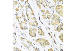 Immunohistochemistry of paraffin-embedded human stomach using MLN antibody at dilution of 1:100 (40x lens). (Motilin 抗体)