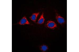 Immunofluorescent analysis of Calnexin staining in HeLa cells. (Calnexin 抗体  (C-Term))