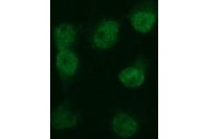 Image no. 3 for anti-Tubulin, beta 2B (TUBB2B) antibody (ABIN1501572) (TUBB2B 抗体)
