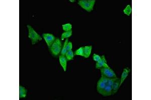 Immunofluorescent analysis of PC-3 cells using ABIN7151501 at dilution of 1:100 and Alexa Fluor 488-congugated AffiniPure Goat Anti-Rabbit IgG(H+L) (ETFDH 抗体  (AA 318-617))
