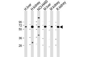 All lanes : Anti-PCK1 Antibody (C-term) at 1:2000 dilution Lane 1: Human liver lysate Lane 2: Human kidney lysate Lane 3: NCI- whole cell lysate Lane 4: Mouse liver lysate Lane 5: Mouse kidney lysate Lane 6: Rat kidney lysate Lysates/proteins at 20 μg per lane.