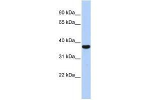 EXOSC2 antibody used at 1 ug/ml to detect target protein. (EXOSC2 抗体  (Middle Region))