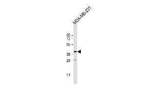 Western Blot at 1:1000 dilution + MDA-MB-231 whole cell lysate Lysates/proteins at 20 ug per lane. (TAS2R31 抗体  (C-Term))
