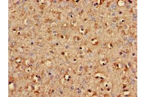 Immunohistochemistry of paraffin-embedded human brain tissue using ABIN7170725 at dilution of 1:100 (STMN2 抗体  (AA 61-129))