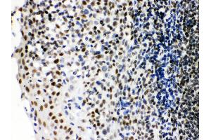 Anti- Ku70 Picoband antibody, IHC(P) IHC(P): Human Tonsil Tissue (XRCC6 抗体  (C-Term))