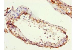 Immunohistochemistry of paraffin-embedded human testis tissue using ABIN7176044 at dilution of 1:100 (ZCCHC13 抗体  (AA 1-166))