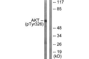 Western blot analysis of extracts from mouse liver cells, using Akt (Phospho-Tyr326) antibody. (AKT1 抗体  (pTyr326))