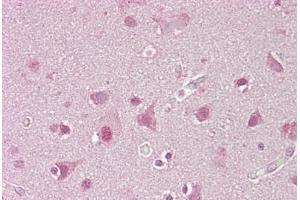 Immunohistochemistry (IHC) image for anti-Sterol Regulatory Element Binding Transcription Factor 1 (SREBF1) (AA 461-510) antibody (ABIN6748655)