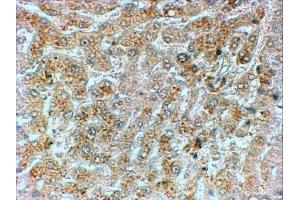 ABIN184571 (2µg/ml) staining of paraffin embedded Human Liver. (GADD34 抗体  (C-Term))