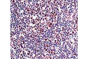 RUNX2 antibody immunohistochemistry analysis in formalin fixed and paraffin embedded human tonsil tissue. (RUNX2 抗体  (AA 445-474))