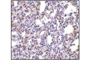 Immunohistochemistry of PKR in rat lung tissue with this product at 2. (EIF2AK2 抗体  (C-Term))