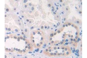 DAB staining on IHC-P; Samples: Human Kidney Tissue (CX3CL1 抗体  (AA 81-336))