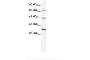 Image no. 1 for anti-Gap Junction Protein, delta 3, 31.9kDa (GJD3) (AA 31-80) antibody (ABIN202183) (Gap Junction Protein, delta 3, 31.9kDa (GJD3) (AA 31-80) 抗体)