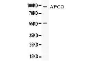Western blot analysis of APC2 expression in HELA whole cell lysates ( Lane 1). (APC2 抗体  (N-Term))