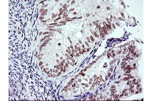 Image no. 3 for anti-Ring Finger Protein 113B (RNF113B) antibody (ABIN1500715) (RNF113B 抗体)