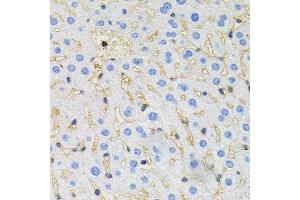 Immunohistochemistry of paraffin-embedded mouse liver using MAPT antibody (ABIN5970456) at dilution of 1/100 (40x lens). (MAPT 抗体)