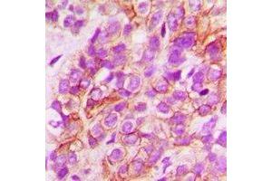 Immunohistochemistry (IHC) image for anti-N-Myc Downstream Regulated 1 (NDRG1) antibody (ABIN7308066) (NDRG1 抗体)