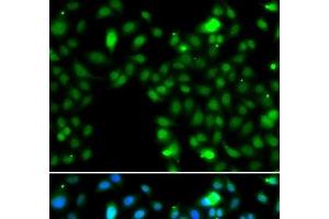 Immunofluorescence analysis of MCF-7 cells using ING5 Polyclonal Antibody (ING5 抗体)