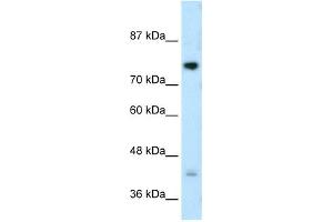 RNF186 antibody used at 1 ug/ml to detect target protein.