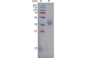 SDS-PAGE (SDS) image for anthrax Toxin Receptor 1 (ANTXR1) (AA 33-321) protein (His tag) (ABIN7092772)