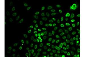 Immunofluorescence analysis of HeLa cells using BRG1/BRG1/SM antibody (ABIN6133730, ABIN6148100, ABIN6148101 and ABIN7101348). (SMARCA4 抗体  (AA 30-130))