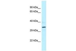Image no. 1 for anti-Protein Phosphatase 2A Activator, Regulatory Subunit 4 (PPP2R4) (AA 39-88) antibody (ABIN6747835) (PPP2R4 抗体  (AA 39-88))