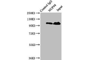 Immunoprecipitating NUP98 in Jurkat whole cell lysate Lane 1: Rabbit control IgG instead of ABIN7161832 in Jurkat whole cell lysate. (NUP98 抗体  (AA 965-1110))