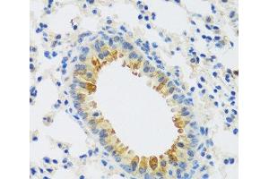 Immunohistochemistry of paraffin-embedded Mouse lung using CAMK1 Polyclonal Antibody at dilution of 1:100 (40x lens). (CAMK1 抗体)