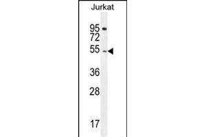 DARS Antibody (N-term) (ABIN655040 and ABIN2844671) western blot analysis in Jurkat cell line lysates (35 μg/lane). (DARS 抗体  (N-Term))