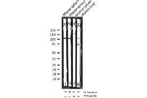 Western blot analysis of Phospho-NF kappaB p105/p50 (Ser927) expression in various lysates (NFKB1 抗体  (pSer927))