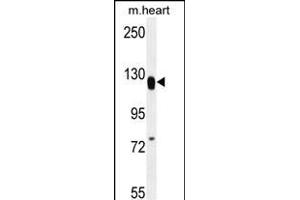 MED14 Antibody (Center) (ABIN656136 and ABIN2845475) western blot analysis in mouse heart tissue lysates (35 μg/lane). (MED14 抗体  (AA 586-615))