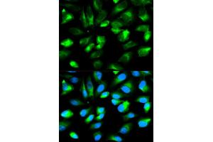 Immunofluorescence analysis of HeLa cells using ARHGDIA antibody. (ARHGDIA 抗体)