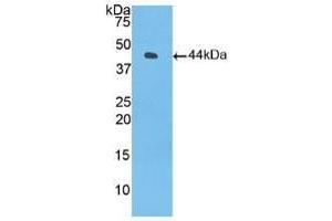 Detection of Recombinant C3, Human using Polyclonal Antibody to Complement Component 3 (C3) (C3 抗体  (AA 1000-1326))