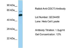 Host: Rabbit Target Name: CDC73 Sample Type: Human Hela Cell Antibody Dilution: 1. (HRPT2 抗体  (C-Term))