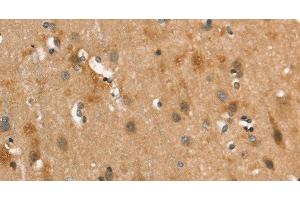 Immunohistochemistry of paraffin-embedded Human brain using CALCRL Polyclonal Antibody at dilution of 1:40 (CALCRL 抗体)