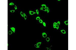 Detection of GCLM in MCF7 cells using Polyclonal Antibody to Glutamate Cysteine Ligase, Modifier Subunit (GCLM) (GCLM 抗体  (AA 40-251))