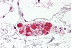 Image no. 2 for anti-Discs, Large Homolog 4 (Drosophila) (DLG4) (AA 683-732) antibody (ABIN6749749) (DLG4 抗体  (AA 683-732))