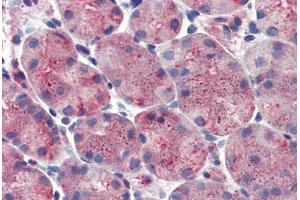 Stomach: Formalin-Fixed, Paraffin-Embedded (FFPE) (ERP44 抗体  (Internal Region))