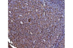 IHC analysis of CD40/TNFRSF5 using anti-CD40/TNFRSF5 antibody (ABIN4886525). (CD40 抗体  (AA 21-193))