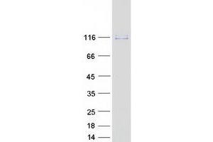 Western Blotting (WB) image for Oxysterol Binding Protein-Like 3 (OSBPL3) (Transcript Variant 3) protein (Myc-DYKDDDDK Tag) (ABIN2727988)