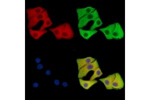 ABIN7096493 and ABIN7100557 staining Hela cells by IF/ICC. (CCDC124 抗体)