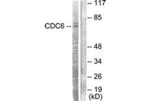 Western Blotting (WB) image for anti-Cell Division Cycle 6 Homolog (S. Cerevisiae) (CDC6) (AA 20-69) antibody (ABIN2888619) (CDC6 抗体  (AA 20-69))