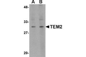 Western blot analysis of TEM2 in human colon tissue lysate with this product at (A) 1 and (B) 2 μg/ml. (RASD2 抗体  (C-Term))